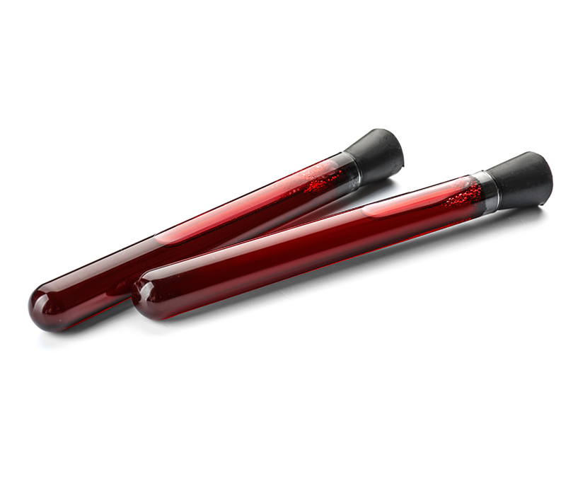 Evaluate underlying causes